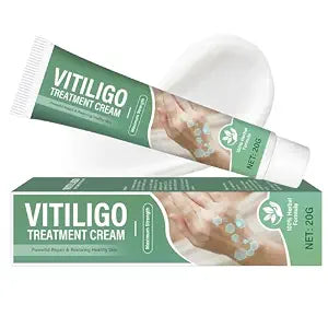 Vitiligo Cream for Face and Body, Natural Herbal Cream for Spots