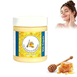 Psoriasis Cream, Propolis Honey Skin Cream, Deep Moisturizing & Nourishing Skin, Fast-Absorbing & Non-Greasy, Suitable for Dry & Rough Skin, Unisex