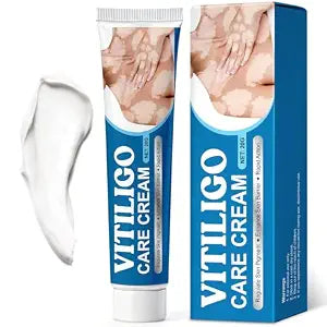Vitiligo Treatment Cream for Men & Women, Vitiligo Cream, 20g