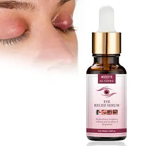 Styes Eye Relief Serum, 30ml Moisturize Blepharitis & Chalazion Remover, Gentle Under Eyelid Serum For Dark Circles, Puffiness.