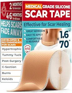 MYHELP Medical Grade Silicone Scar Tape - 1.6"x70" - Effective Scar Removal
